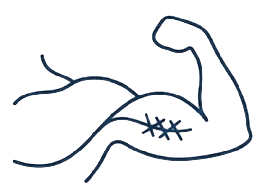 Chirurgie du Sportif